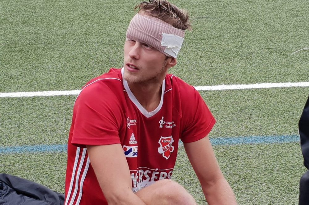 Rasmus avgjorde - sen skallade han sönder ögonbrynet
